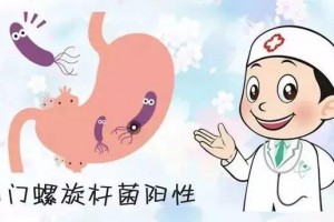 我国幽门螺旋杆菌感染率约60%健康保胃战打响